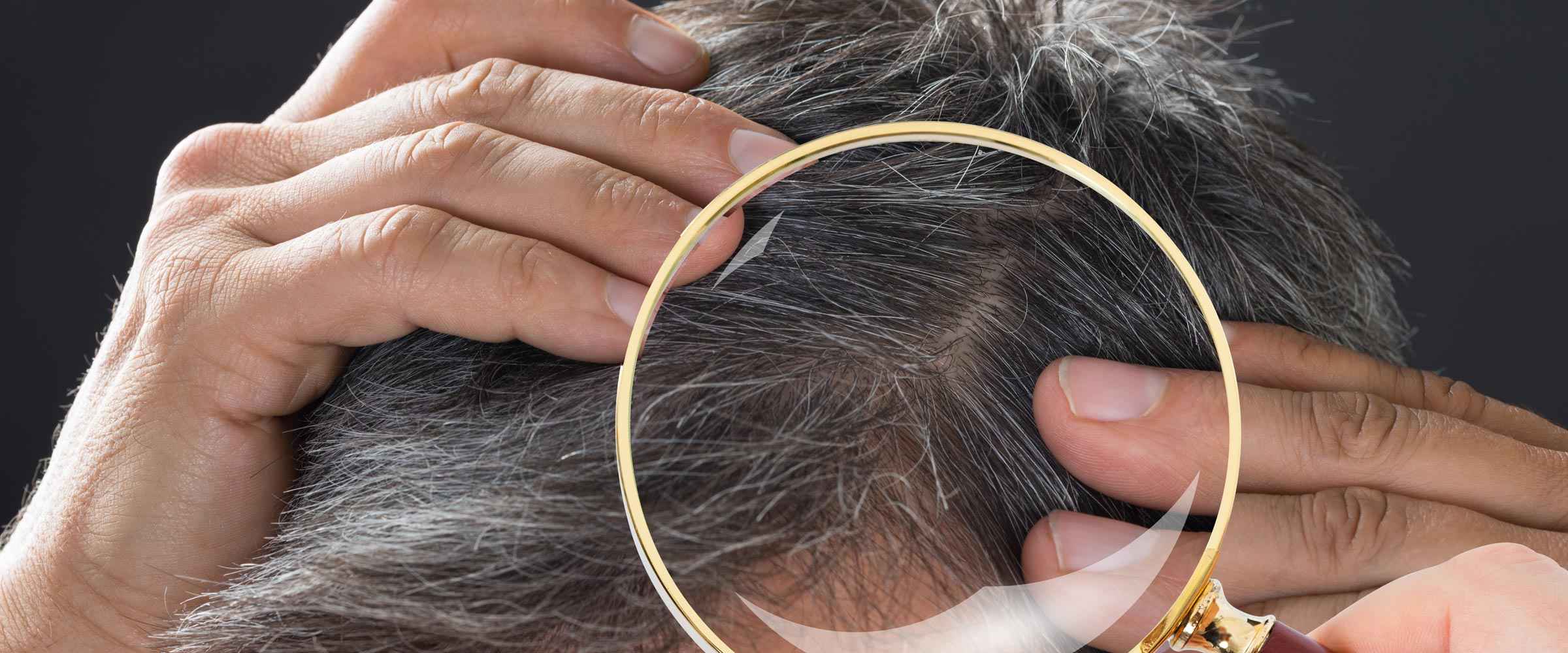 Hair Shedding vs Hair Loss | How to Tell the Difference and What to Do Is Hair Shedding Normal?